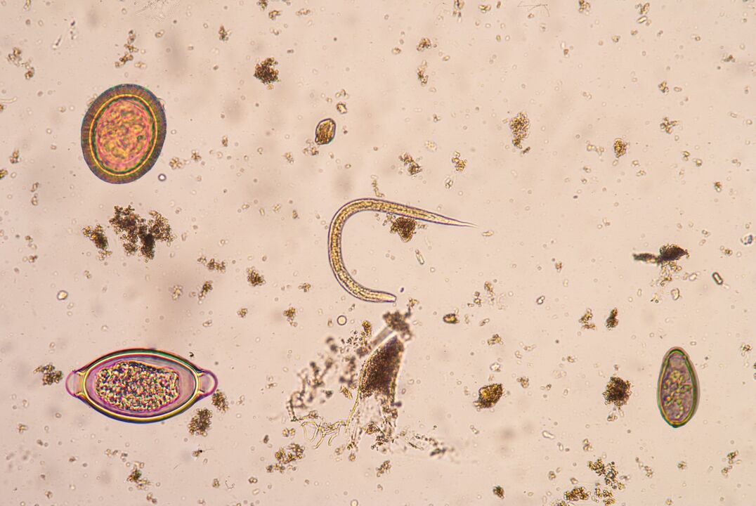 Stage of subcutaneous parasite larvae