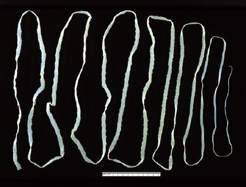 Tape extracted from human intestine