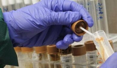 Need to make parasite analysis