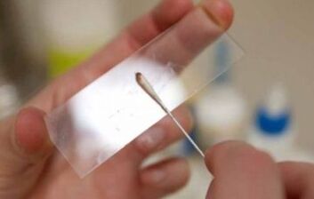 What tests should be taken for parasites