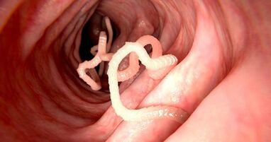 Causes of parasite in the human body