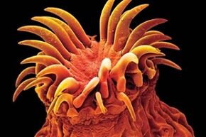 Trematode parasites in humans